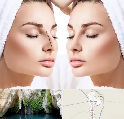 عمل بینی در خورموج