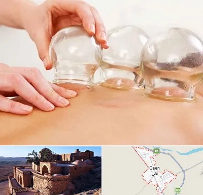 بادکش درمانی در قائن