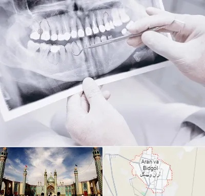 رادیولوژی دهان و دندان در آران و بیدگل
