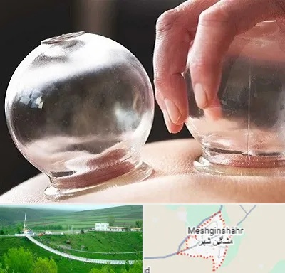 مرکز حجامت در مشگین شهر