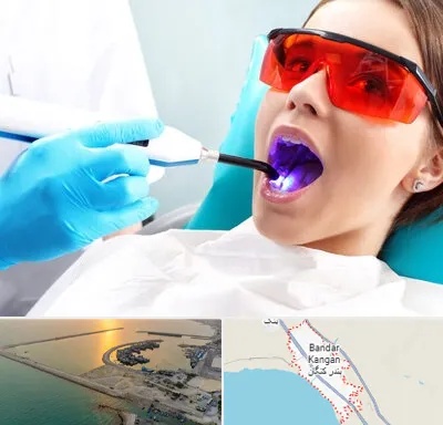 جراحی لثه با لیزر در بندر کنگان
