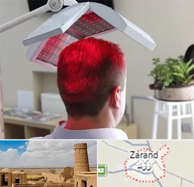 کاشت مو با لیزر در زرند