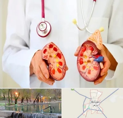 دکتر سنگ کلیه در بروجن
