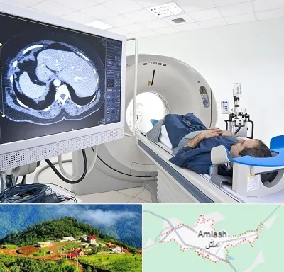 مرکز تصویر برداری پزشکی در املش