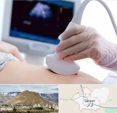سونوگرافی در گراش