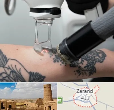 ریمو تاتو در زرند