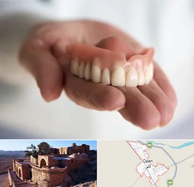 لیفت لثه با لیزر در قائن
