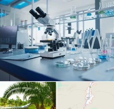 آزمایشگاه زگیل تناسلی در کهنوج