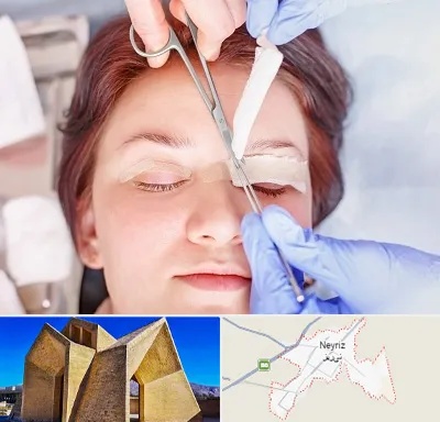 جراحی پلک افتاده در نی ریز