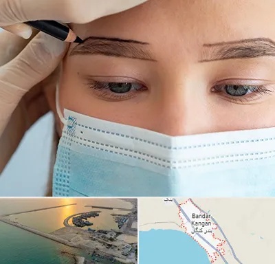 کاشت ابرو در بندر کنگان
