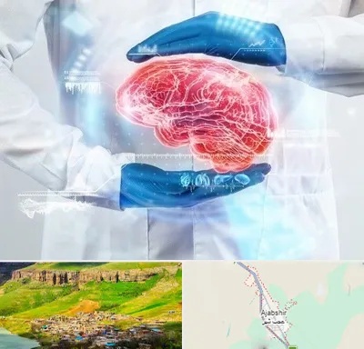 دکتر مغز و اعصاب در عجب شیر