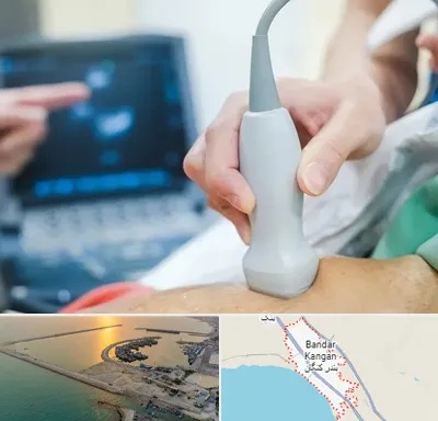 اکو قلب شبانه روزی در بندر کنگان