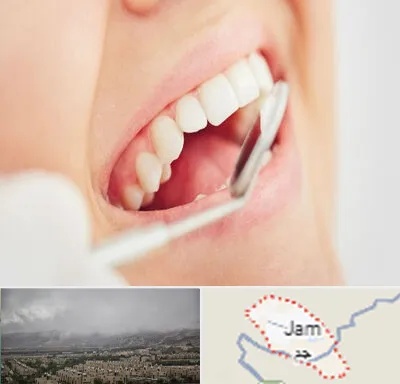 اصلاح طرح لبخند در جم