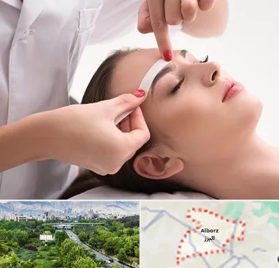 اپیلاسیون در البرز