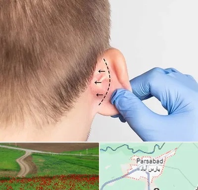 عمل زیبایی گوش در پارس آباد