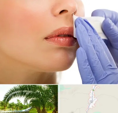 اپیلاسیون صورت در کهنوج