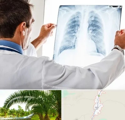 دکتر متخصص ریه در کهنوج
