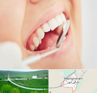 اصلاح طرح لبخند در مشگین شهر