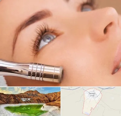 میکرودرم در گرمسار