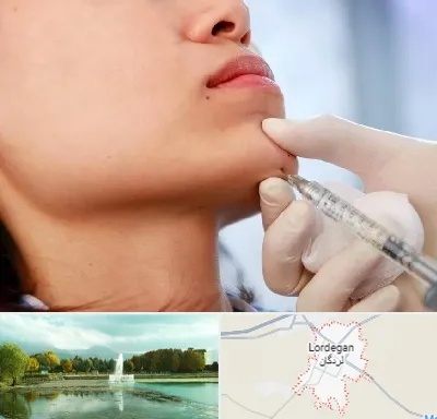 زاویه سازی صورت در لردگان