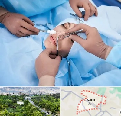 عمل بینی فانتزی در البرز