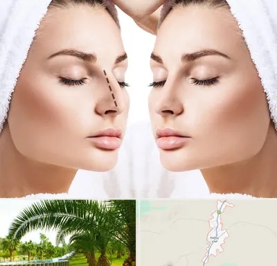 عمل بینی در کهنوج