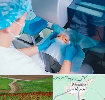 دکتر عمل لازک چشم در پارس آباد