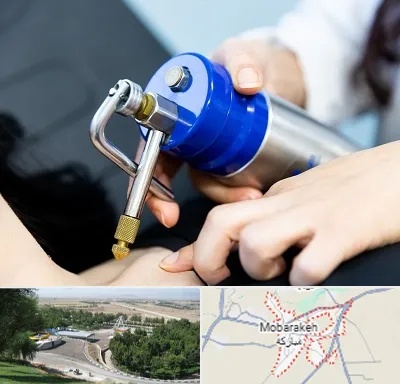 کرایوتراپی در مبارکه