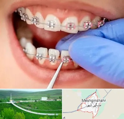 مرکز ارتودنسی دندان در مشگین شهر