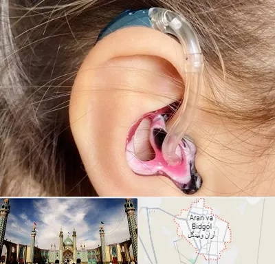 ساخت قالب سمعک در آران و بیدگل