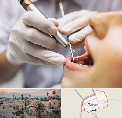 دندانپزشکی ارزان در طبس