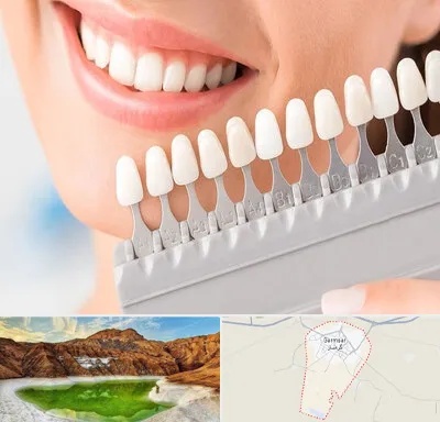 متخصص لمینت دندان در گرمسار
