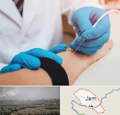 مرکز نوار عصب و عضله در جم