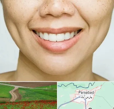 عمل چال گونه در پارس آباد