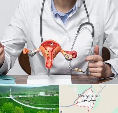 جراح سرطان رحم در مشگین شهر