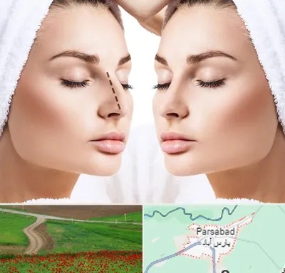 عمل بینی در پارس آباد