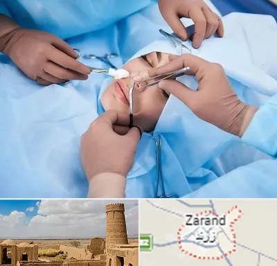 عمل بینی فانتزی در زرند