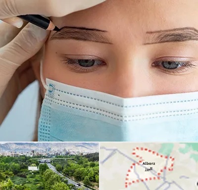 کاشت ابرو در البرز