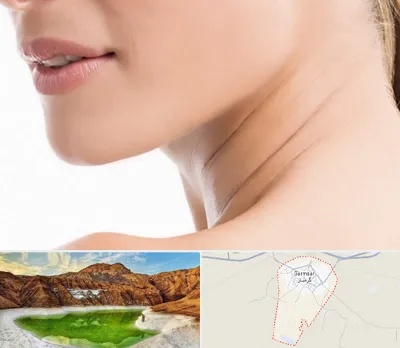 جراحی فک با لیزر در گرمسار