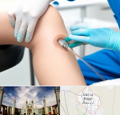 اوزون تراپی در آران و بیدگل