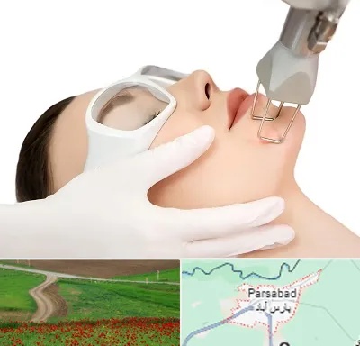 لیزر فرکشنال در پارس آباد