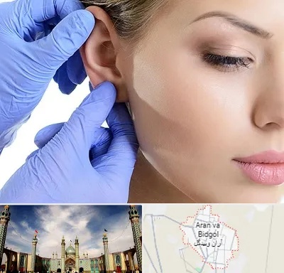 اتوپلاستی در آران و بیدگل