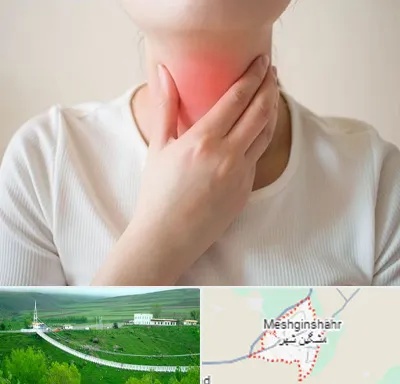 دکتر سرطان مری در مشگین شهر