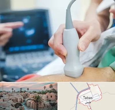 اکو قلب شبانه روزی در طبس