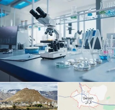 آزمایشگاه زگیل تناسلی در گراش