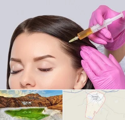 تزریق هیر فیلر در گرمسار