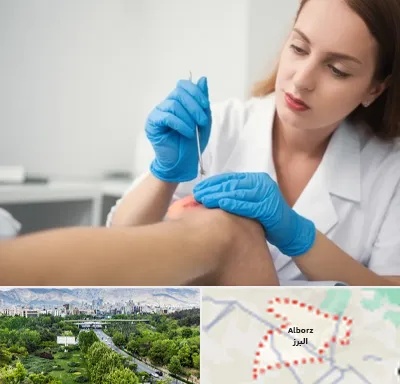 متخصص زخم در البرز