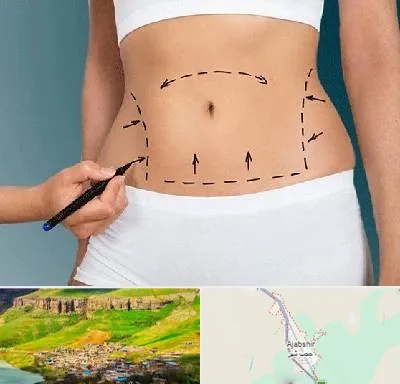 دکتر طب سنتی برای لاغری در عجب شیر