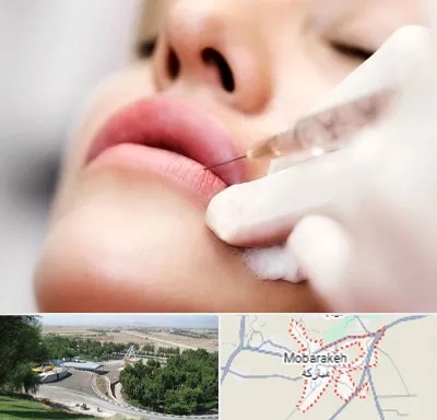 کلینیک تزریق ژل لب در مبارکه
