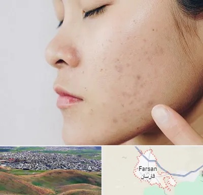 دکتر جوش صورت در فارسان